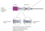 Игла для спинальной анестезии, Sprotte (Спротте) р. 27Gх3 1/2 90 мм №1 арт. 121251-27A с интродьюсером